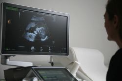 emedical-center_ultrasound