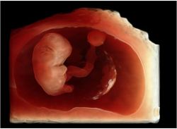 Early-Health_1st_trimester_embryo